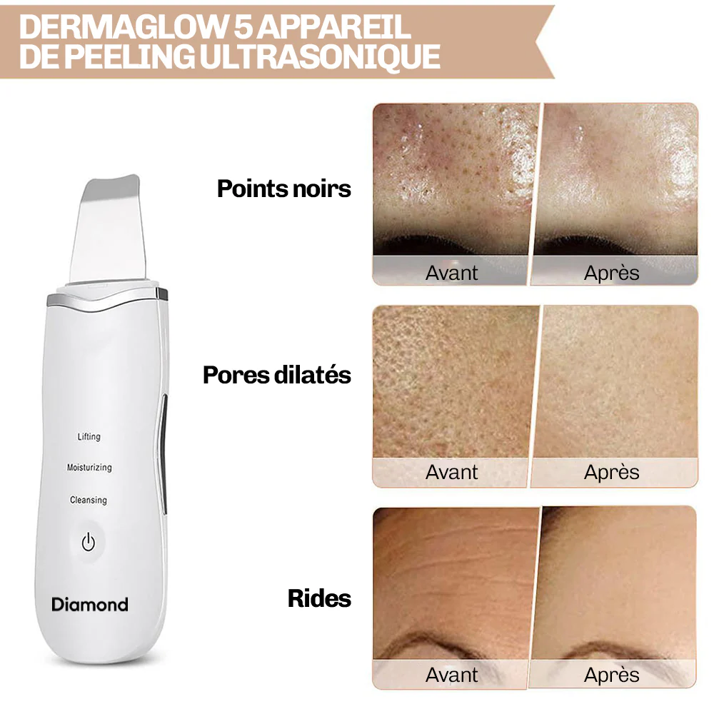 DermaGlow 5 - Ultrasons Peeling Visage - Image 6
