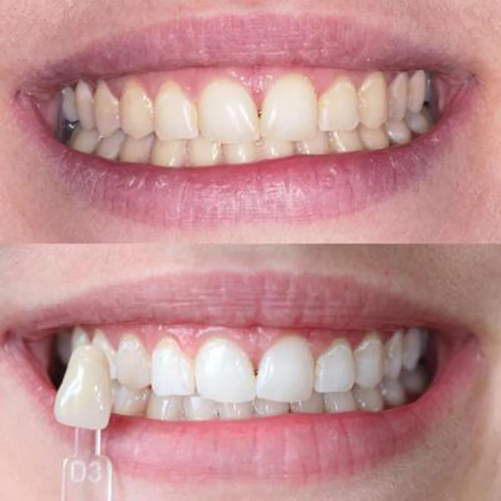 Bleaching Glow Stick - Image 8