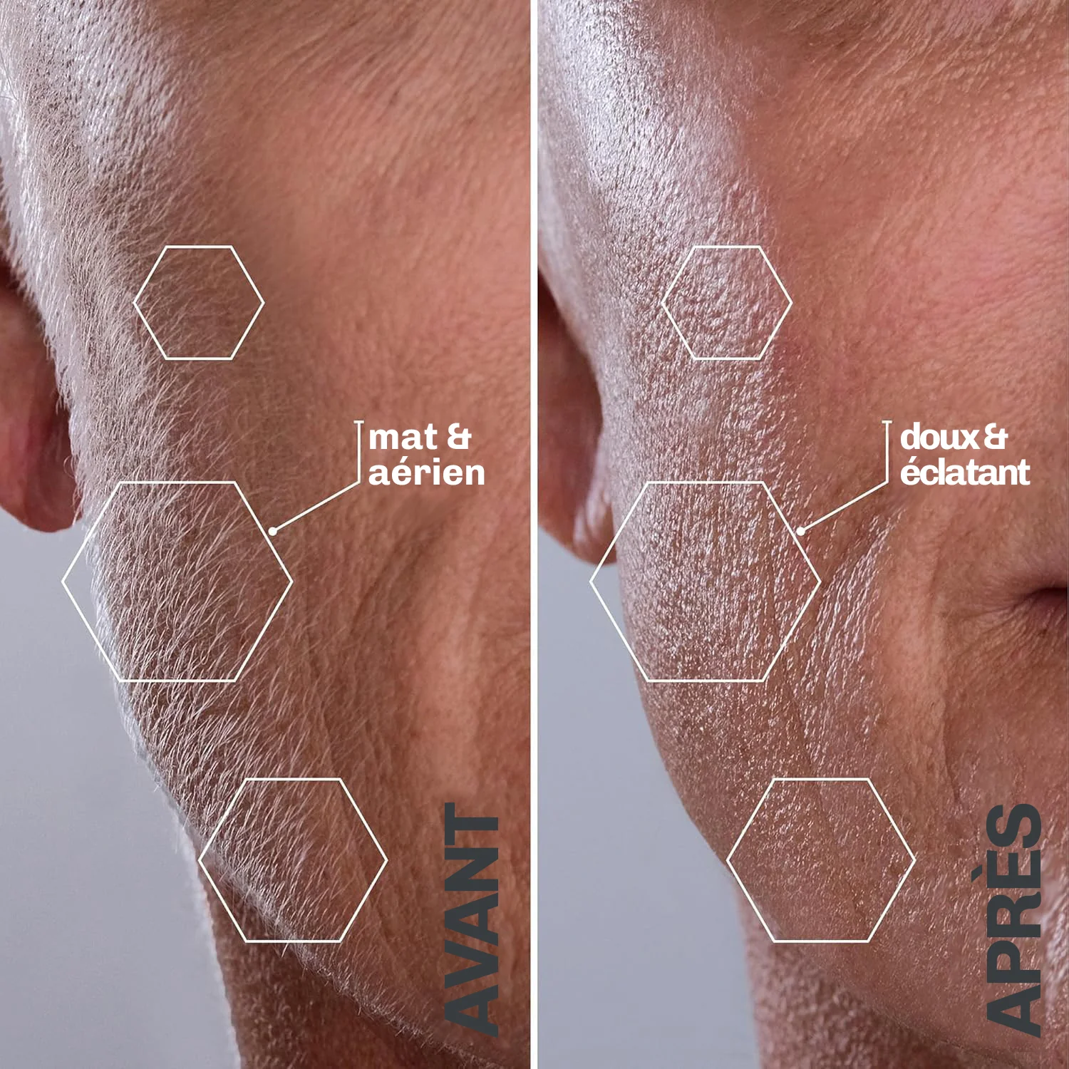 SILKYFLASH+ Dermaplaning Sonique Visage - Image 7