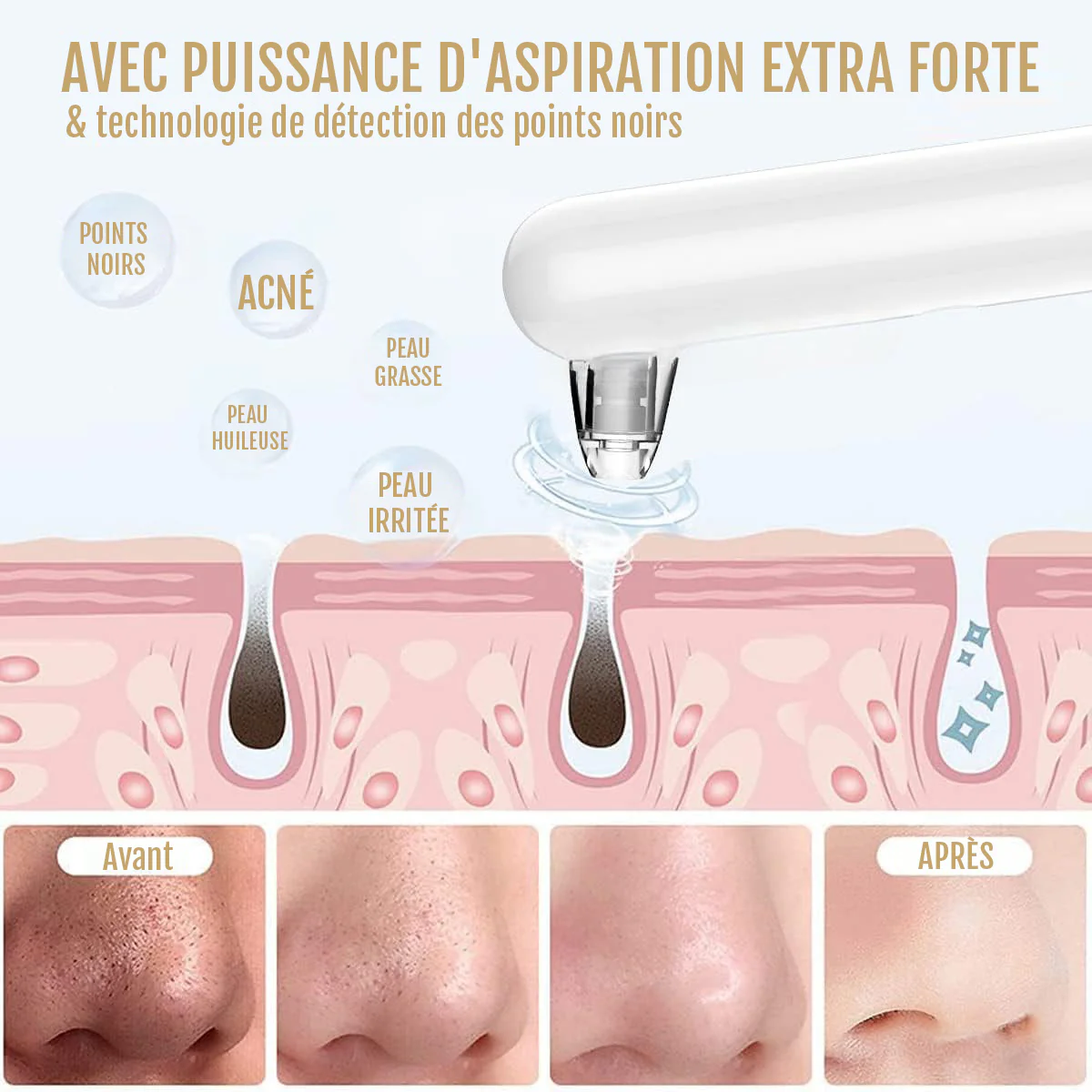 Kit Peau Nette LumiPore - Image 9