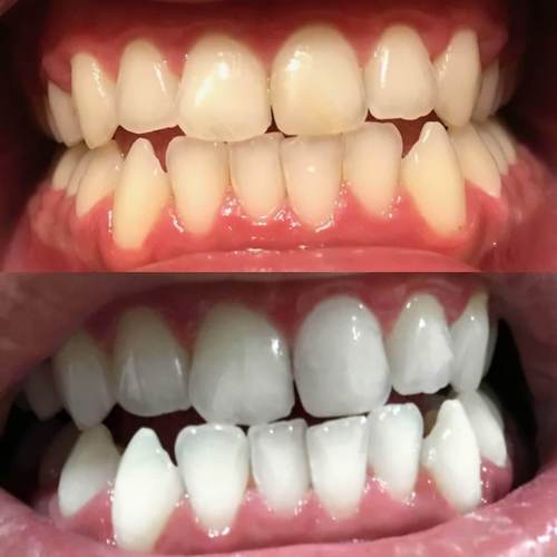 PAP+ Dentifrice - Image 10
