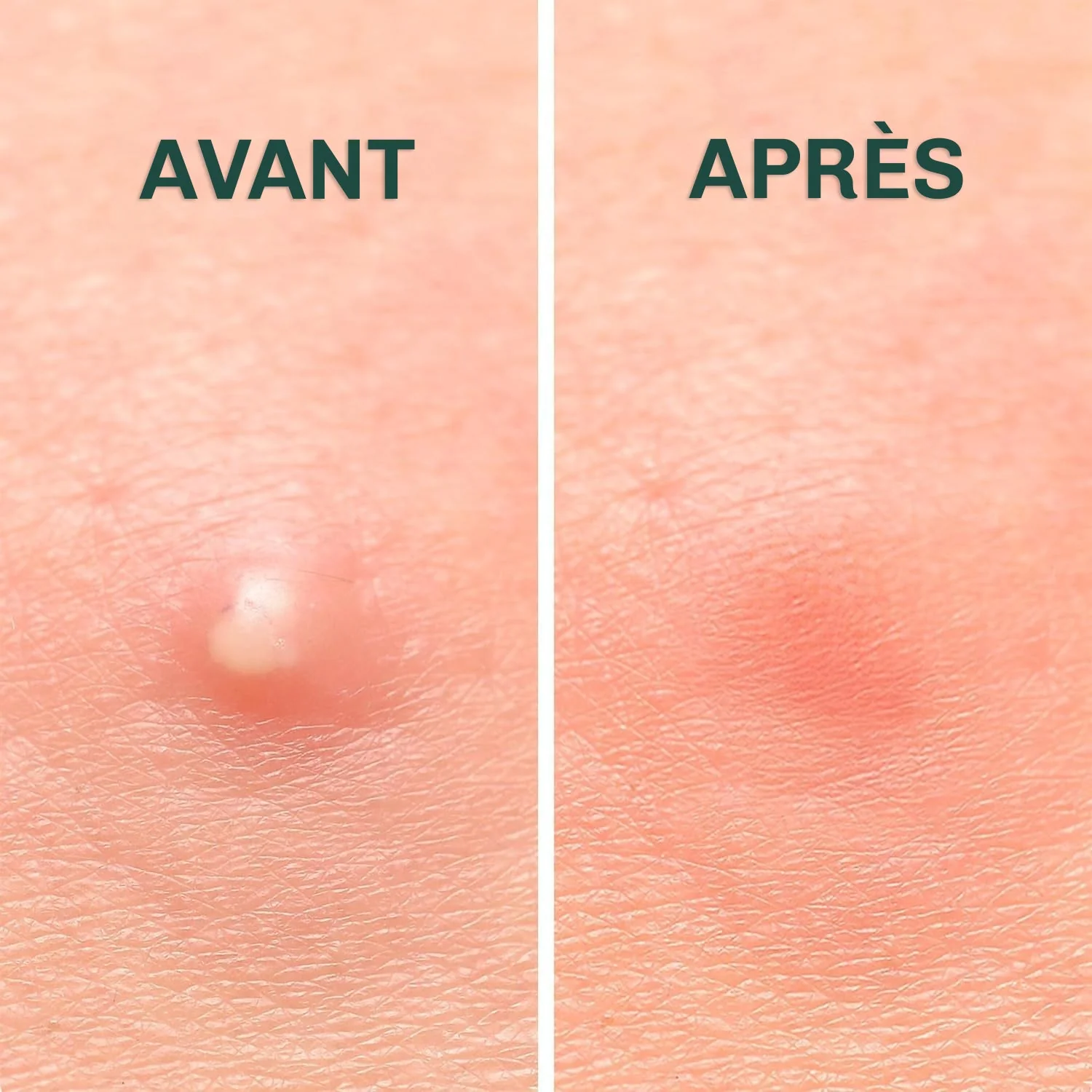 Patchs anti-boutons invisibles - Image 9